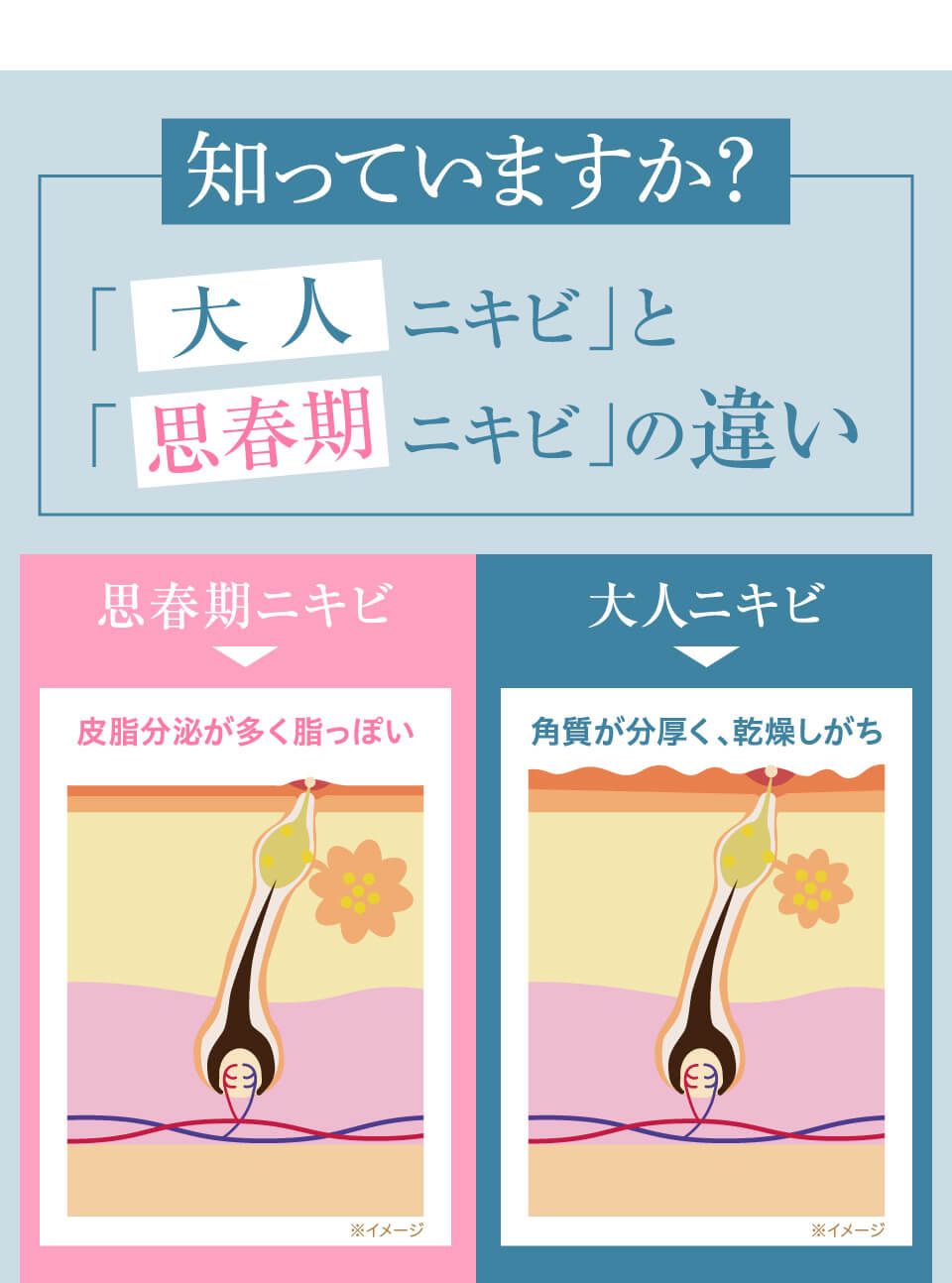 ニキビ集中ケアコース