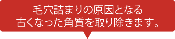毛穴詰まりの原因となる古くなった角質を取り除きます