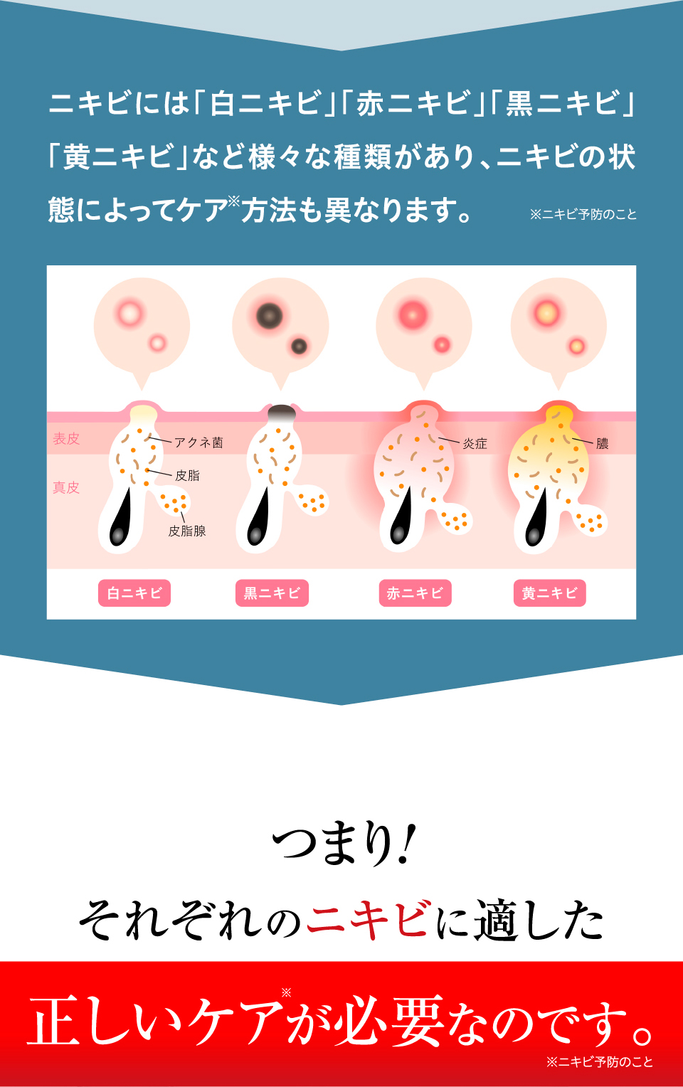 ニキビ集中ケアコース