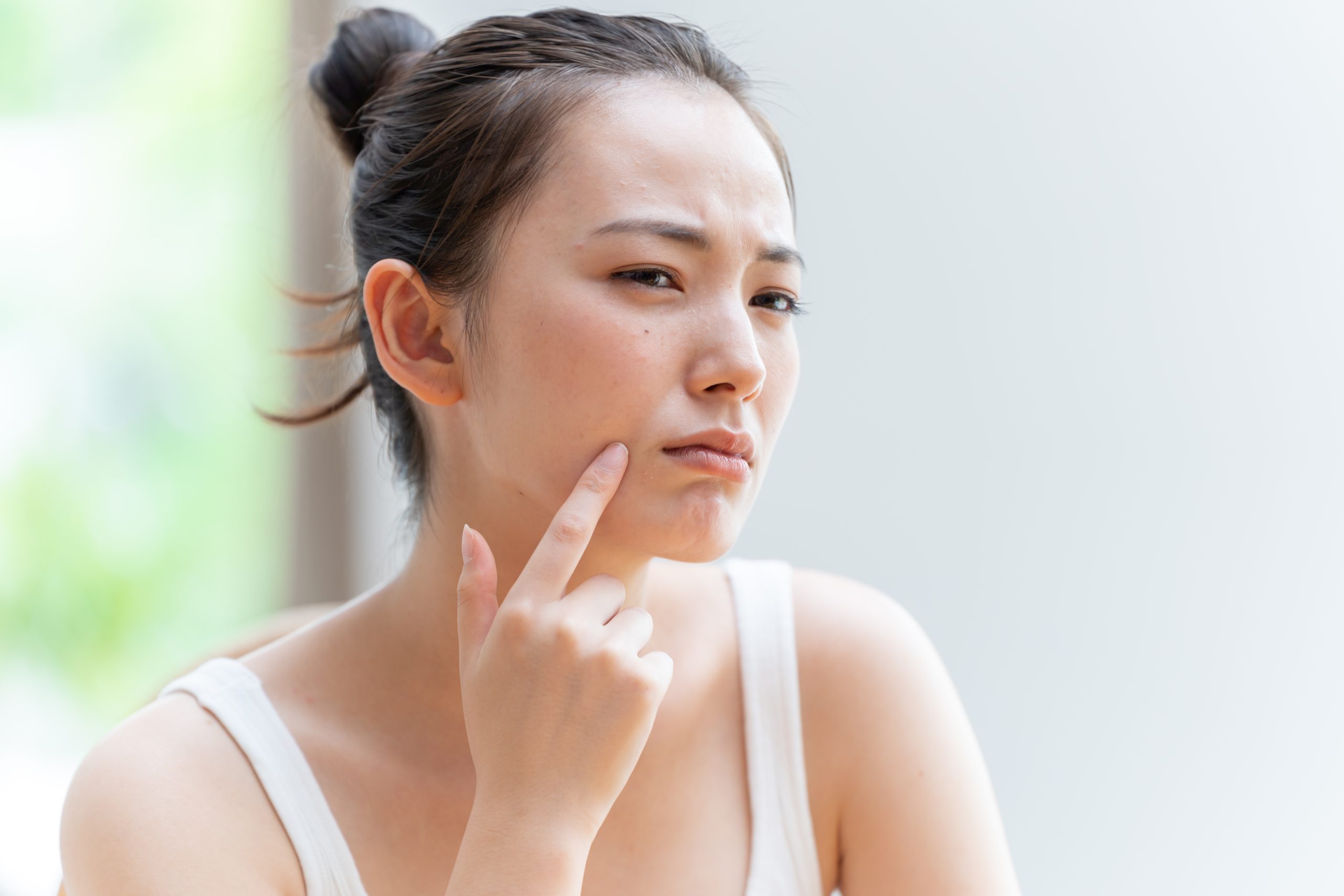 フェイシャルエステでニキビ予防｜ニキビができる前のケアで美肌キープ