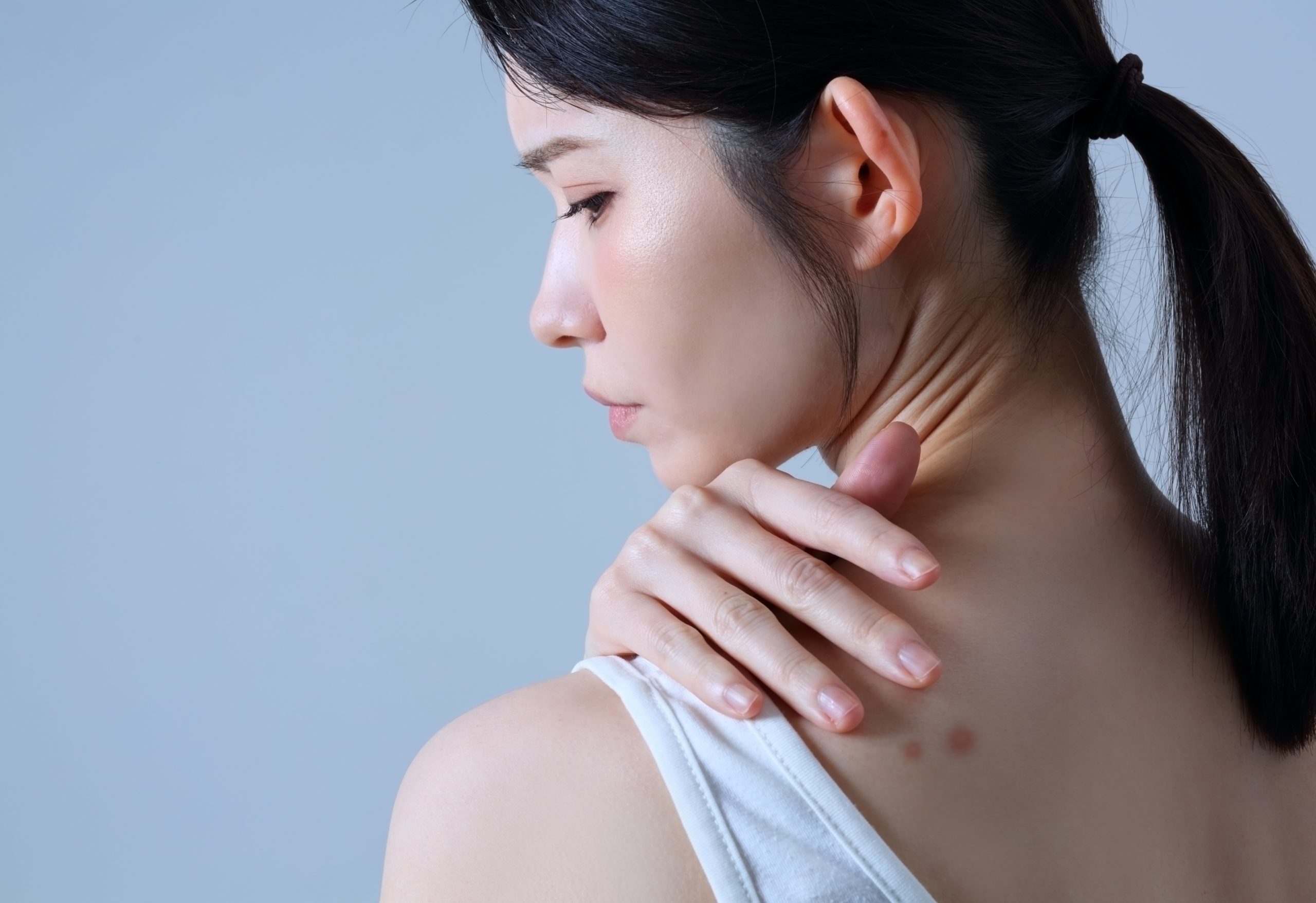 背中ニキビが治らない原因と対処方法について｜毎日のニキビケアで意識したいポイント